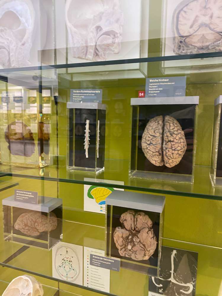 Basel, Musée Anatomique Bâle